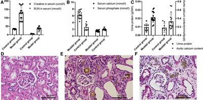 Altered serum metabolome associated with vascular calcification developed from CKD and the critical pathways